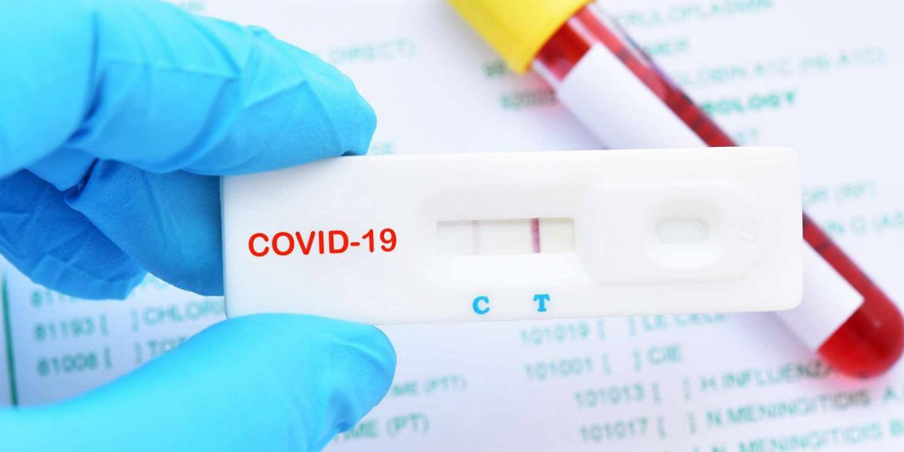 Hızlı Covid Testi Ne Kadar Sürede Çıkar, Doğruluk Payı Ne Kadar Yüksek?