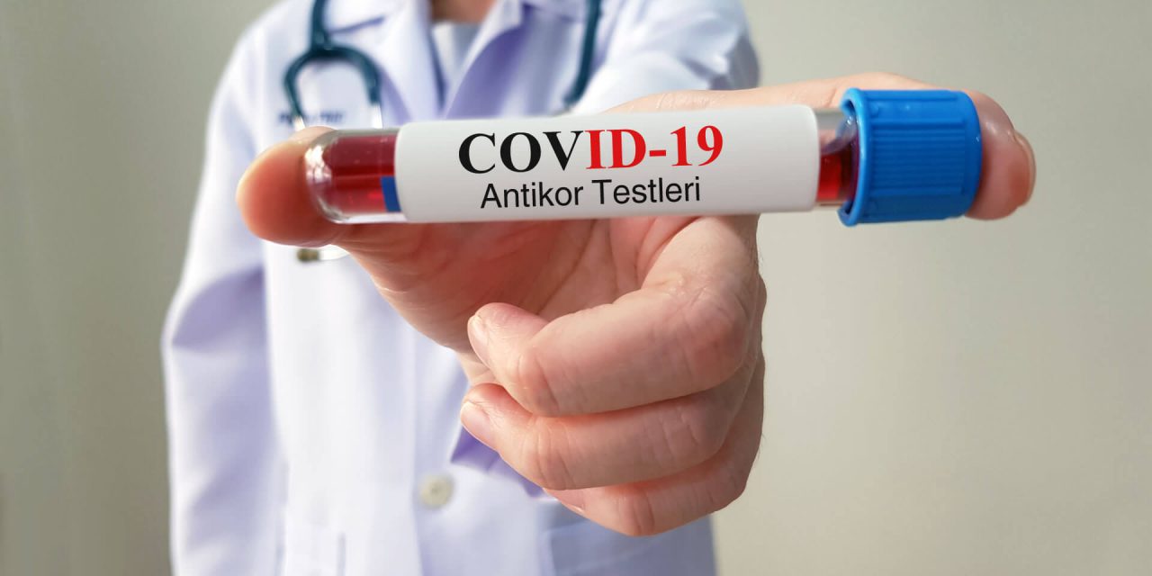 Covid – 19 Antikor Testleri İle İlgili Merak Ettikleriniz
