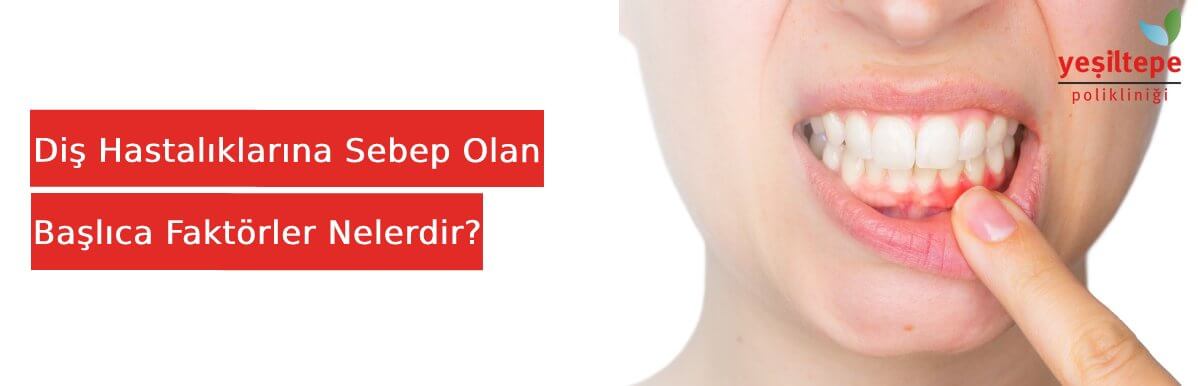 Diş Hastalıklarına Sebep Olan Başlıca Faktörler Nelerdir?