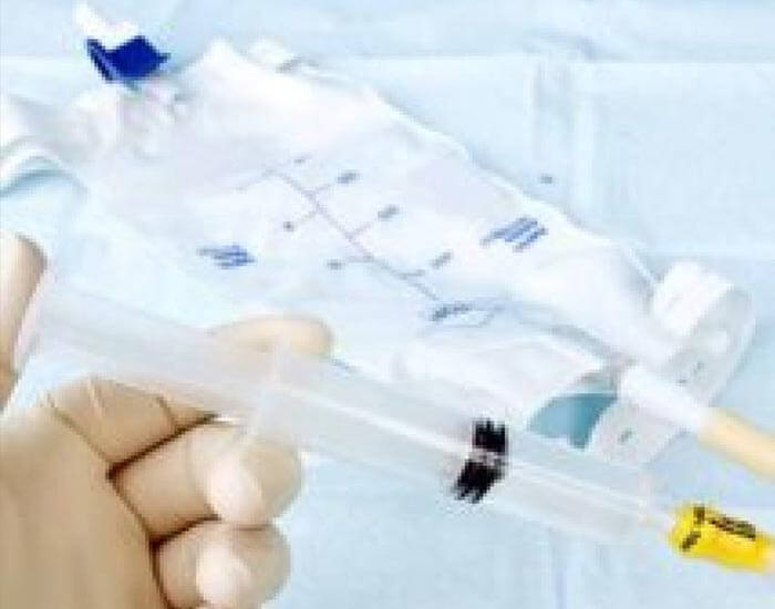 evde-sonda-cikarma evde-sonda-cikarma